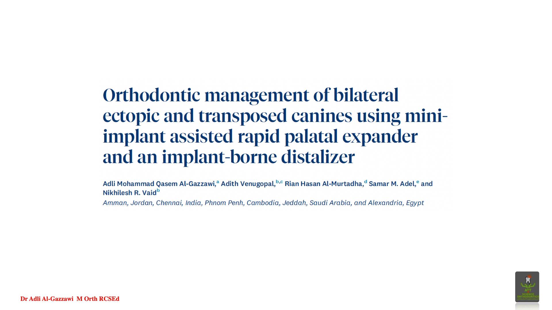إدارة تقويمية لحالة الأنياب المنطمّة ثنائياً (Ectopic) والمتبادلة الموضع (Transposed) باستخدام موسّع الحنك السريع المثبَّت على الزرعات الصغيرة (Mini-implant assisted rapid palatal expander) وجهاز الإرجاع الخلفي المعتمد على الزرعات (Implant-borne distalize